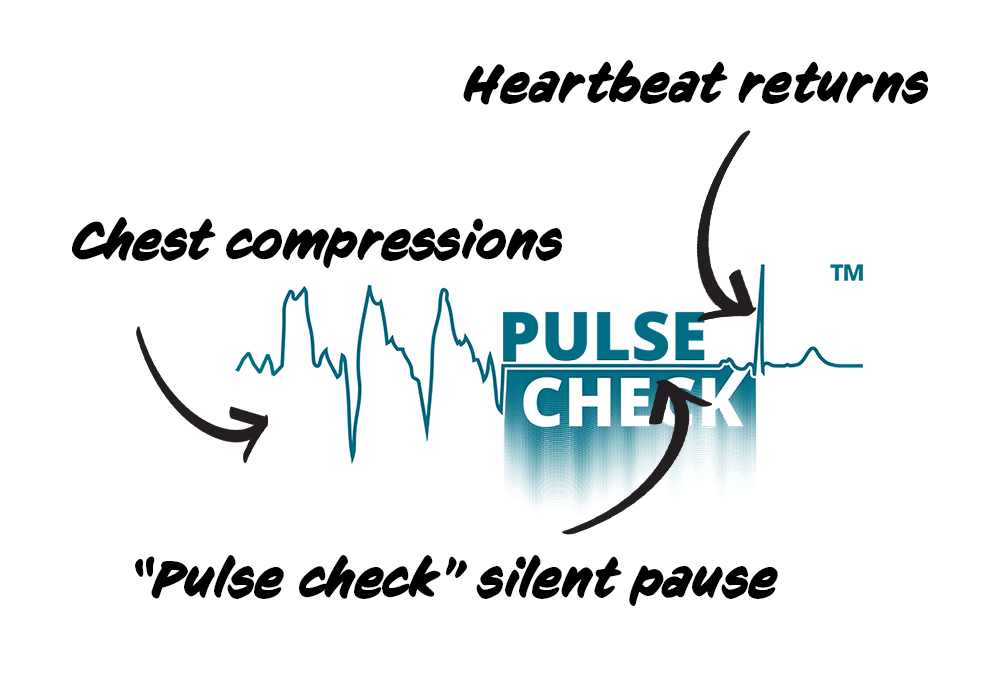 infographic explaining pulse check logo