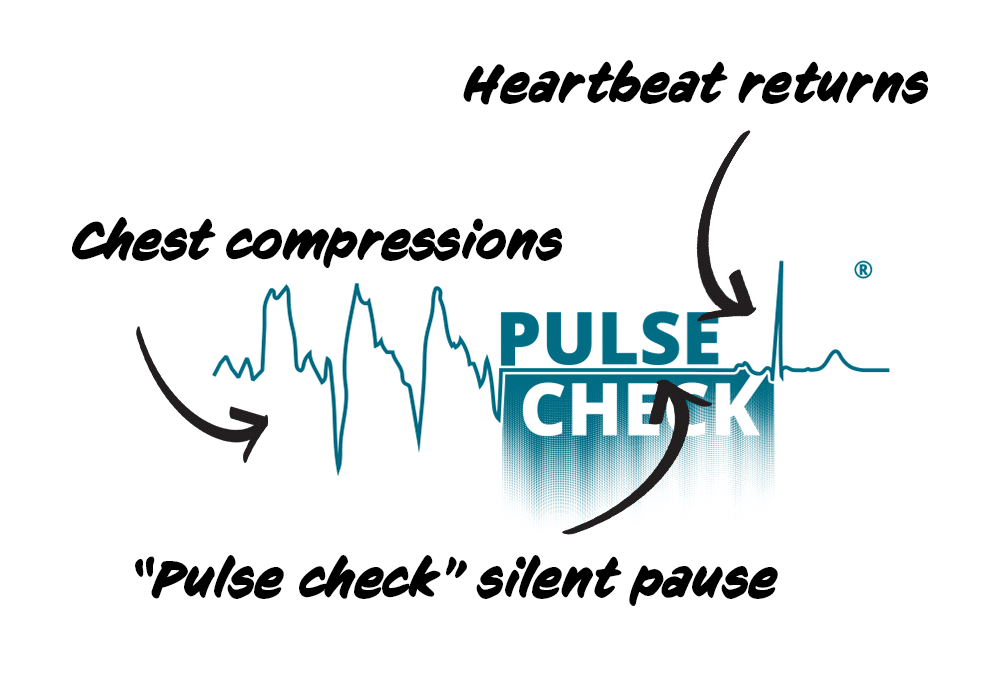 pulse check infographic updated